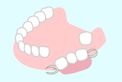 部分義歯/入れ歯