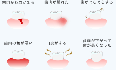 このような症状はございませんか？